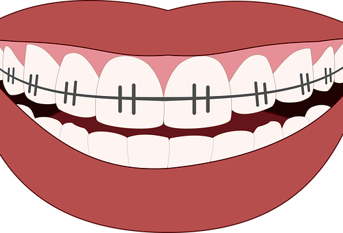 Przeglądy dentystyczne – dlaczego warto regularnie robić